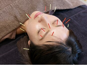 たかはし治療院の写真/ほうれい線とたるみへアプローチ！美容鍼でエイジングケア◎最新美容で美肌への道をサポートします♪
