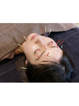 ホウレイ線・たるみ改善！予防ケア