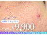 皮脂トラブル【毛穴の開き、黒ずみ、ニキビ】あなたにあった改善プランを提案