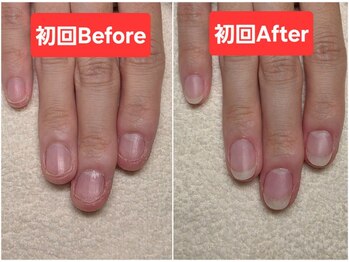 マニブルーム/長さ出しBefore&After左手