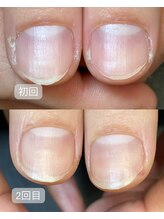 キラリネイル(KIRARINAIL)/お客さまの変化