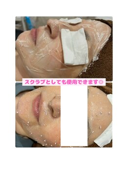 ムゥ(muu)/BBL光フェイシャル