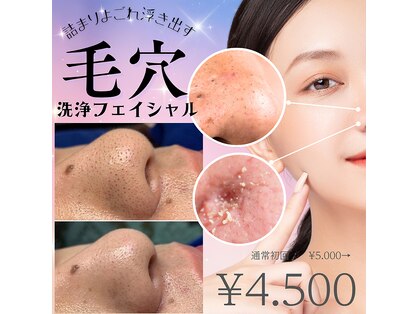 ミラー(MIRAOR)の写真