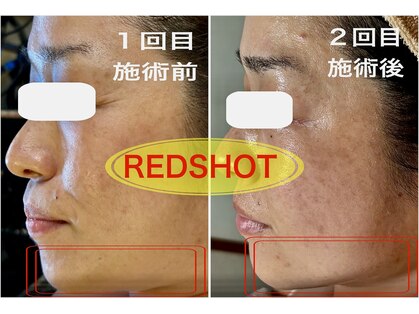 ナニ(nani)の写真
