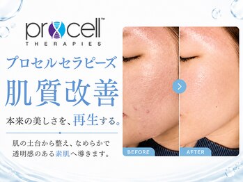 ラヴィ(Ravi)の写真/肌管理のプロが叶える！プロセルフェイシャルで本気の肌質改善を実感◎！烏丸エリアアクセス抜群♪