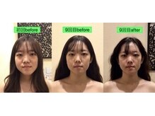 アジール 長岡リバーサイド千秋店(agir)/before/after画像