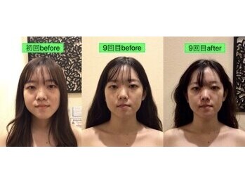 アジール 長岡リバーサイド千秋店(agir)/before/after画像