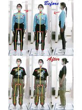 姫路なごみ整体院 なごみ鍼灸院/腰痛・反り腰・猫背