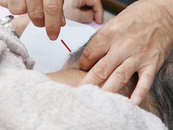 ふくだ鍼灸マッサージ治療院の写真/【首肩が辛い方必見！】原因は血行不良が多数！鍼で血流改善し、楽な身体に♪鍼灸＋マッサージのSETも◎