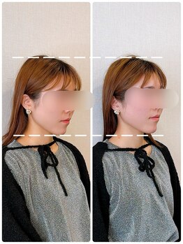 イズム まつもと店(izm)/ストレートネック