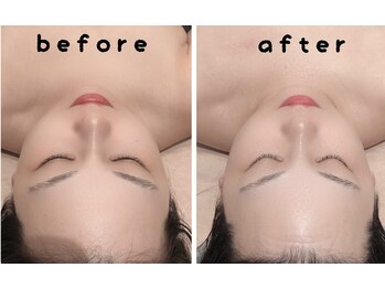 ポノ(PONO)/エアバリで美白ケア