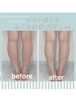 ハロ 南青山(HALO)/レモンボトル8cc