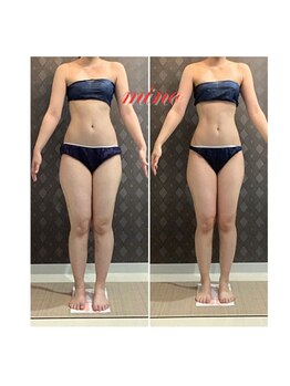 ミノ 美里大通り店(mino)/ダイエットパッケージプラン