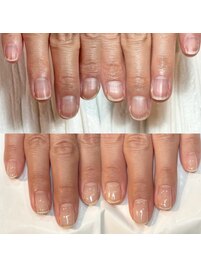 看護師のお客様の自爪育成ネイル