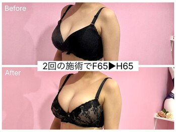 ククナ(KUKUNA)/*バストアップマッサージ*