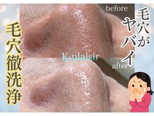 ケイ プレジールの雰囲気（毛穴洗浄ハイドロ☆頑固な汚れを徹底洗浄！黒ずみ★角栓/本町）