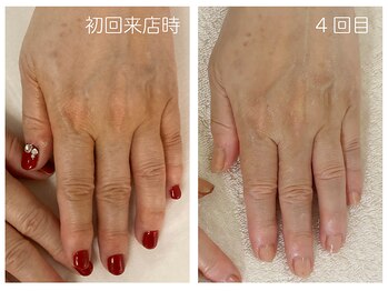 キレイテ 上野店/50代/4回目【ハンドケア上野】