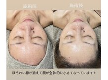 クレヴィー(Creviy)/最先端の細胞美容コース