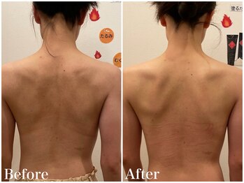 サロンドフェイス(Salon de Faith)/【ブライダル】2回施術♪