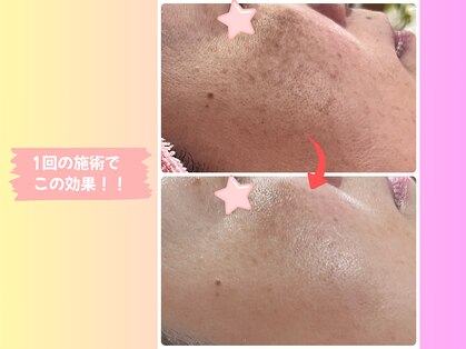 スター(Star)の写真