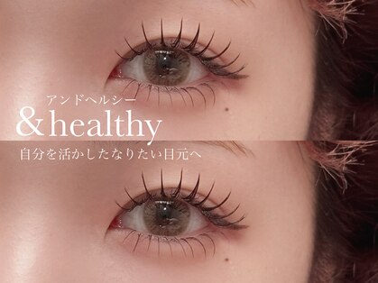 アレア(Alea)の写真