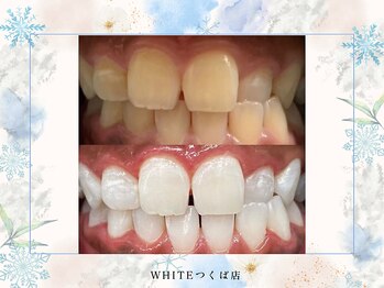 ホワイト つくば店(WHITE)/ビフォーアフター
