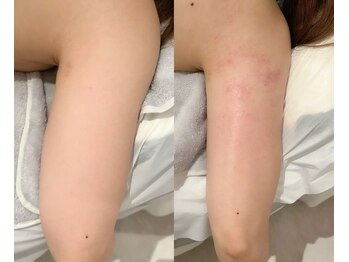 グレアージュ(GLEAGE)の写真/【半身痩身60分◆4,300円】お腹・脚・二の腕など気になる部分の半身集中アプローチ★短期間×持続型の痩身!