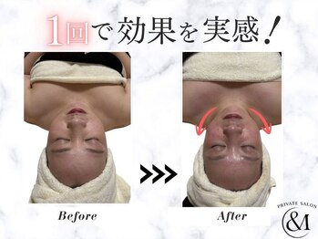 アンドエム(&M)の写真/痛み・摩擦無しで"骨・筋肉から変わる"次世代小顔矯正をご提供。オールハンド×デコルテまでの贅沢施術*