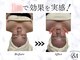 アンドエム(&M)の写真/痛み・摩擦無しで"骨・筋肉から変わる"次世代小顔矯正をご提供。オールハンド×デコルテまでの贅沢施術*