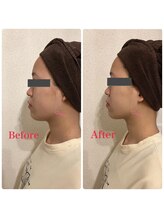 リエット(Lieto)/効果抜群リフトアップメニュー☆