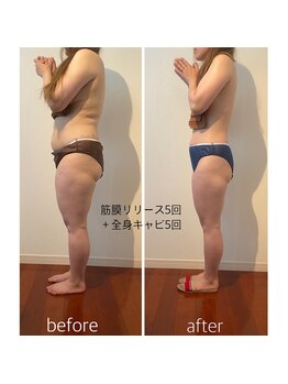 バンブー(bamboo)/ビフォーアフター