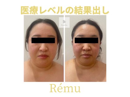 レミュ(Remu)の写真
