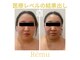 レミュ(Remu)の写真