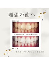 ホワイトニングショップ 新小岩店/ホワイトニング専門店