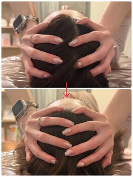 ビノワ(Binowa)/ドライヘッドスパ