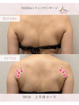 スーペリオル(Superior)/背中のハリ・首肩のコリ改善