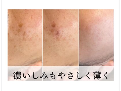 レアリゼアムール(Realiseramour)の写真