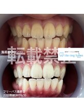 ホワイトニングサロン 熊本店/ホワイトニング通い放題熊本