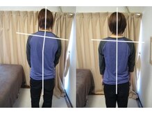 整体いったんとこの雰囲気(自信と前向きになれた【姿勢整体】3回/20代/肩の高さ歪みSネック)