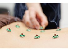 神門整体院 甲東園の雰囲気（【女性施術者のみ】女性ならではのお悩みもぜひご相談ください。）