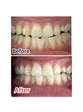 ホワイトニングスタイル 柏店/