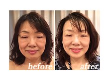 アン グレーヌ 自由が丘(unegraine)/明るいもち肌！口角も上がる