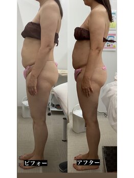 メリアミーゴ(Meli amigo)/50代女性 反り腰改善×猫背改善