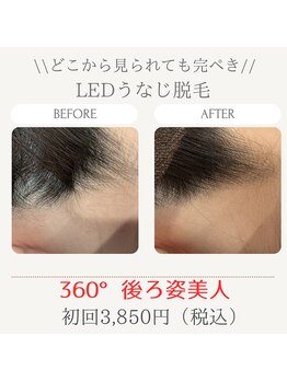 美々庵/LEDうなじ脱毛