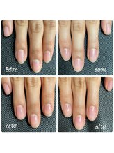 ルームイチマルイチネイルズ(Room101Nails.)/自爪育成・最強のネイルケア鳥取