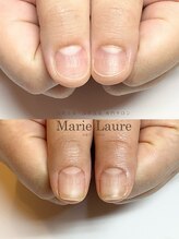 マリーロール 梅田店(Marie Laure)/深爪矯正/自爪育成/自爪風