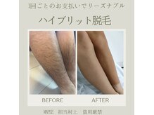 メイプル(Maple)の雰囲気（完全都度払い＋オール単発打ちで当てる高威力脱毛！）