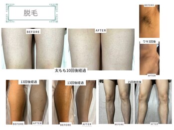 ベルスタイル(Bell style)/当店のお客様症例