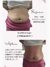 ゴールデンエイジ(Golden Age)/ボディサブスクで1ヶ月の変化