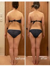 ルーメ(LUME)/パワーレメディ痩身90分